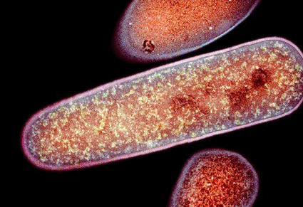 Imagen: Microfotografía electrónica de transmisión a color (TEM) de la bacteria Clostridium difficile (Fotografía cortesía del Dr. Kari Lounatmaa / SPL).